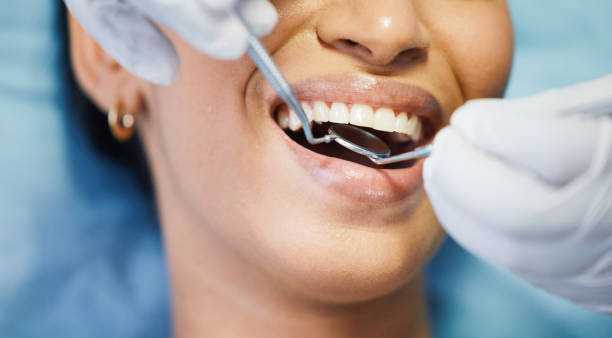 Best Emergency Dental Care for Broken or Chipped Teeth in East Hazel Crest, IL