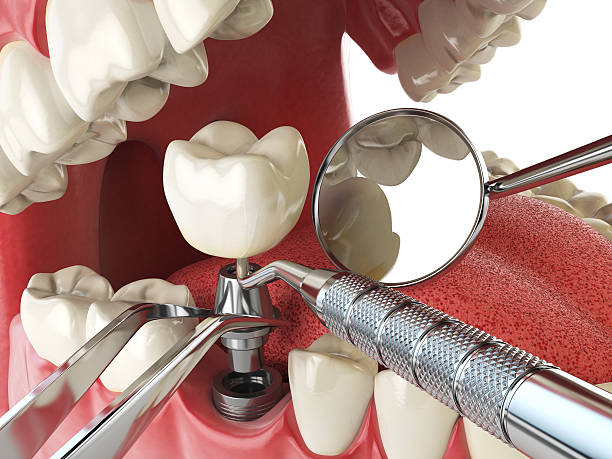 Best Emergency Dental Care for Broken or Chipped Teeth in East Hazel Crest, IL